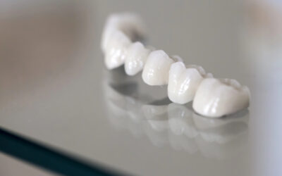 How Dental Veneers Can Transform Women’s Smiles
